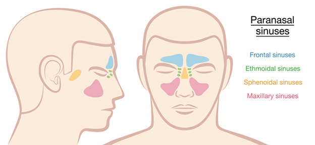 Can Sinus Pressure Cause Neck Pain